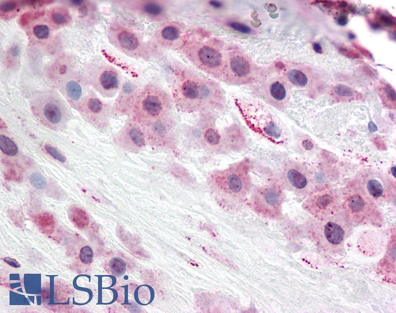 IHC-plus™ Polyclonal Rabbit anti-Human TLR4 Antibody (Internal, IHC)