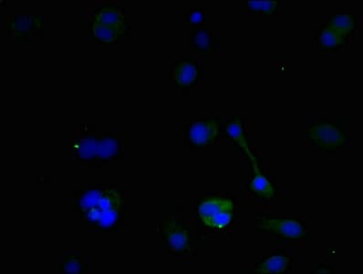 Polyclonal Rabbit anti-Human NIP3 / BNIP3 Antibody (aa1-164, IHC)