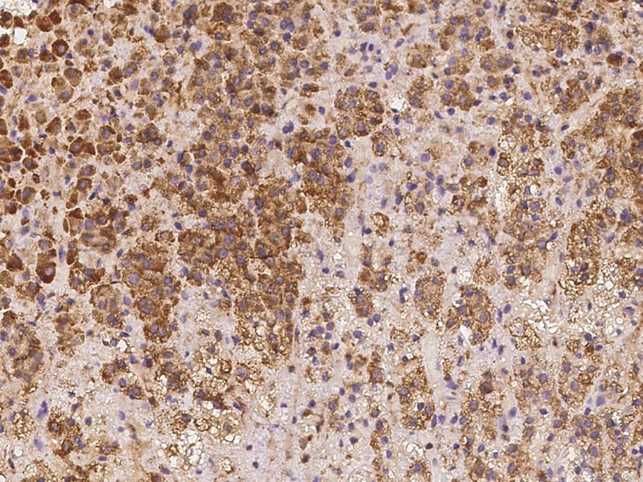 LRRC19 Antibody