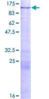 Human HIC2 Protein (Recombinant GST)