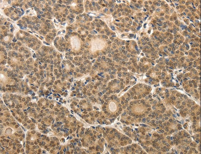 Polyclonal Rabbit anti-Human MAP1L / MAP1A Antibody (IHC)
