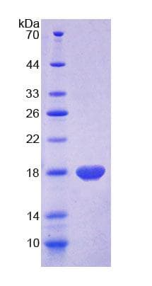Rat MOG Protein (Recombinant His, N-terminus)