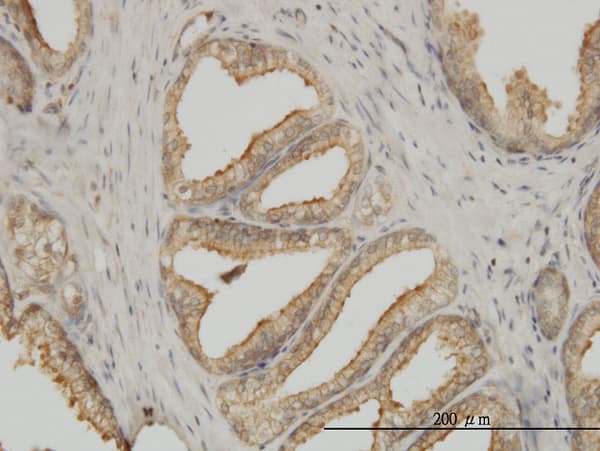 Monoclonal Mouse anti-Human TUBA1B / Tubulin Alpha 1B Antibody (clone 4D1, IHC, IF, WB)