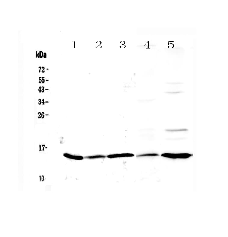 LGALS1 / Galectin 1 Antibody