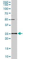 Monoclonal Mouse anti-Human GSTA2 Antibody (clone 3D4, IF, WB)
