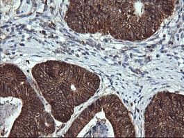 Monoclonal Mouse anti-Human ACAA2 Antibody (clone OTI2F6, IHC, IF, WB)