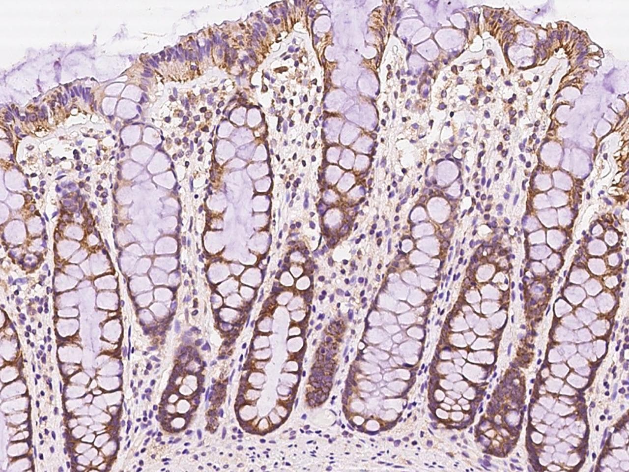 FAIM Antibody