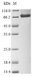 Borna Disease Virus gp84 Protein (Recombinant 6His, N-terminus)
