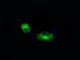 APP / Beta Amyloid Precursor Antibody (clone OTI7B8)