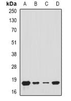 Polyclonal Rabbit anti-Human TIMM17A / TIM17 Antibody (IHC, IF, WB)