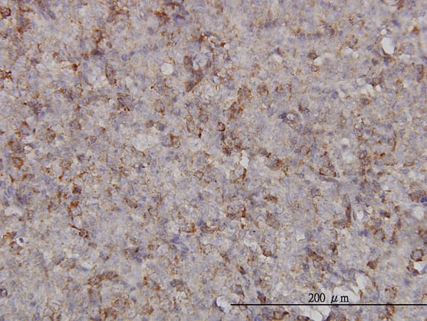 KIF2C / MCAK Antibody (clone 1G2)