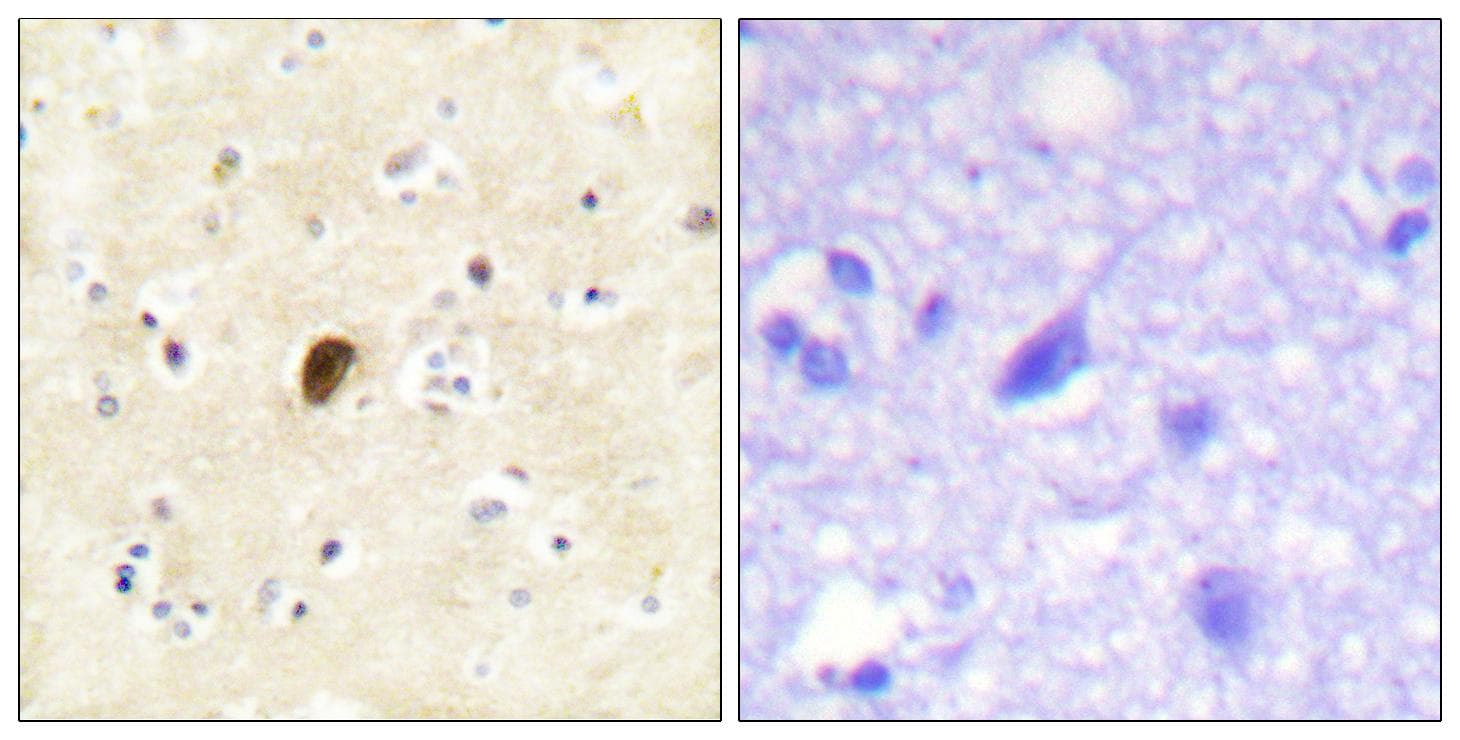 GRIA4 / GLUR4 Antibody (phospho-Ser862)