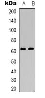 HNF1B / HNF1 Beta Antibody (N-Terminus)