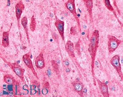 PathPlus™ ADGRG6 / GPR126 Antibody (C-Terminus)