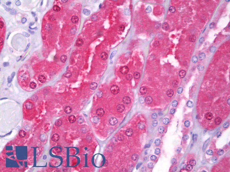 IHC-plus™ HIP1 Antibody (clone 1F12)