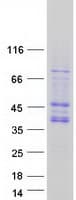 Human CDK10 Protein (Recombinant Myc-DDK (Flag))