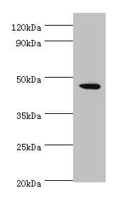 STK32A Antibody (aa1-166)