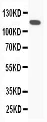 Polyclonal Rabbit anti-Rat Complement C5 Antibody (aa59-77, WB)