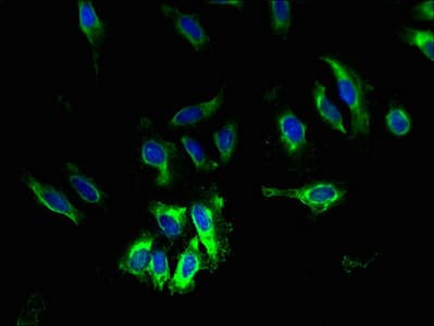 Polyclonal Rabbit anti-Human SLC6A6 / Taurine Transporter Antibody (IHC, WB)