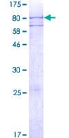 Human ADAT1 Protein (Recombinant GST)