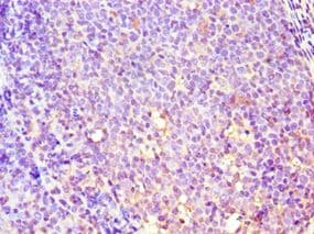 Polyclonal Rabbit anti-Human GBA3 / CBG Antibody (aa1-162, IHC, WB)
