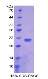 Mouse TLR7 / CD287 Protein (Recombinant His-T7)