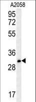 Polyclonal Rabbit anti-Human TRIM73 Antibody (aa161-190, WB)