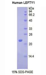 Human LEFTYB / LEFTY1 Protein (Recombinant His)