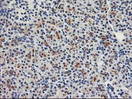 HCA557B / METTL21A Antibody (clone OTI2G7)