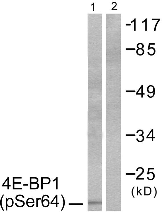 Polyclonal Rabbit anti-Human EIF4EBP1 / 4EBP1 Antibody (phospho-Ser64, IHC, WB)