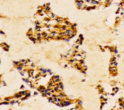 Polyclonal Rabbit anti-Human PI3K Alpha+Gamma Antibody (Tyr467/199, IHC, WB)