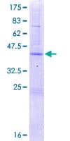 Human REG4 / REG-IV Protein (Recombinant GST)