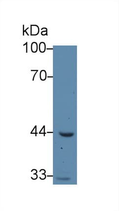 ACAA1 Antibody (APC)