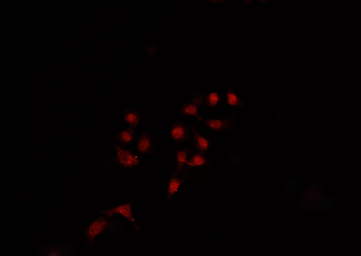 BIK Antibody