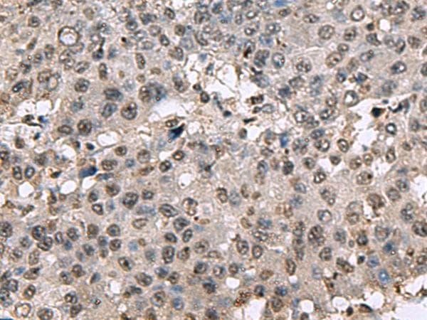 Polyclonal Rabbit anti-Human TMX3 Antibody (IHC)