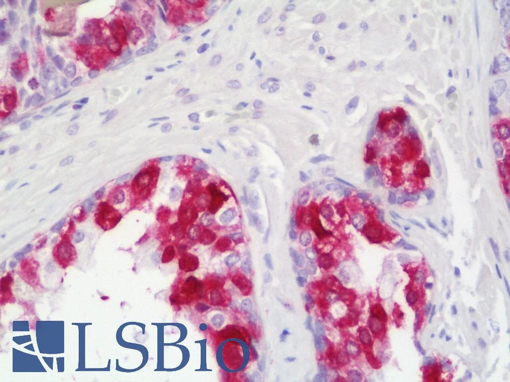 PathPlus™ MEN1 / Menin Antibody (aa575-C-term)