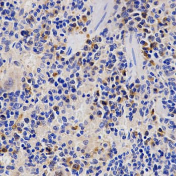 p58 / PSMD3 Antibody