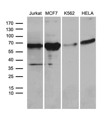 ACVRL1 Antibody (aa22-119, clone OTI5C2)