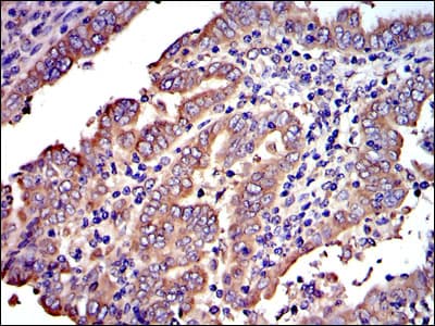 Monoclonal Mouse anti-Human CRK Antibody (clone 3G11E8, IHC, IF, WB)