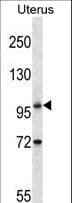 ATG9B Antibody (aa892-921)