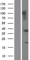 C1QTNF9B Protein (Over-Expression Lysate Myc-DDK (Flag))