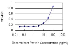 Monoclonal Mouse anti-Human CAT / Catalase Antibody (clone 2G6, WB)