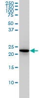 RAB4A / RAB4 Antibody (clone 1C10)