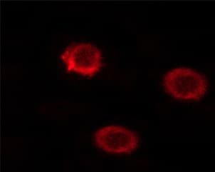 CD45 / LCA Antibody (phospho-Ser1007)