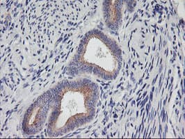 PHF21B Antibody (clone OTI3D1)