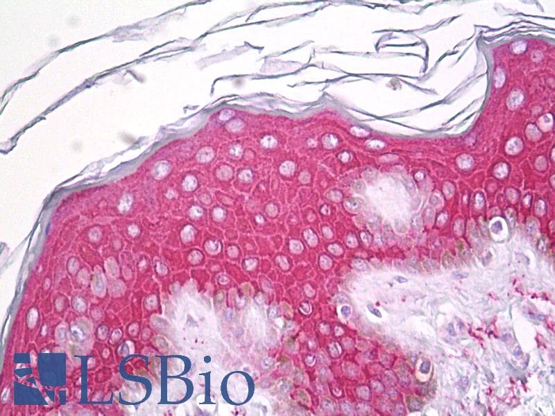 IHC-plus™ Polyclonal Rabbit anti-Human SERINC2 Antibody (aa341-390, IHC, IF, WB)