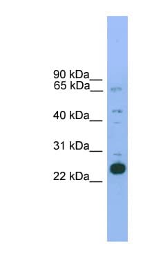 NKX2-6 Antibody (aa74-123)
