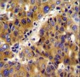 Polyclonal Rabbit anti-Human BCKDHB Antibody (aa41-70, IHC, IF, WB)