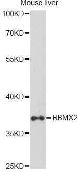 RBMX2 Antibody