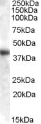 IHC-plus™ Polyclonal Goat anti-Human Aspartate Aminotransferase Antibody (aa157-167, IHC, WB)